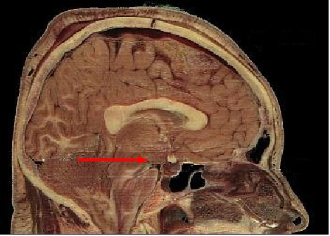 File:Hypothalamus.png