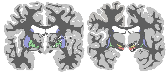 File:Basal-ganglia-coronal-sections-large.png