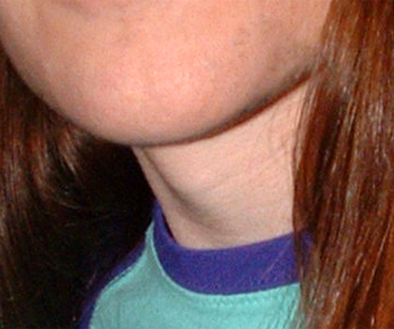 File:Adams apple.png