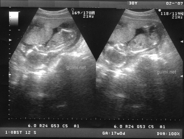 File:Scan17semanas2.png