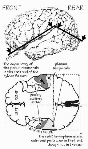 File:Planumtemporal.jpg