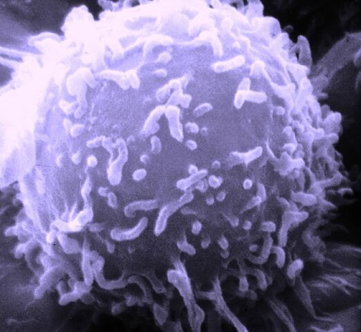 File:SEM Lymphocyte.jpg
