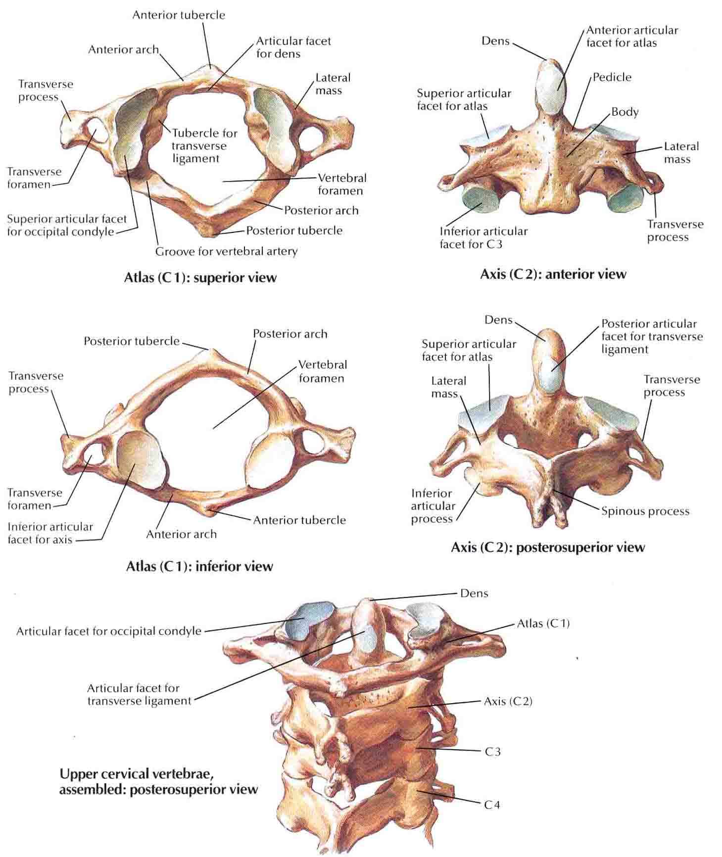 Image Cervical Vertebrae Atlas And Axis1 Ranzcrpart1 Wiki