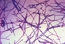 Bacillus anthracis.jpg