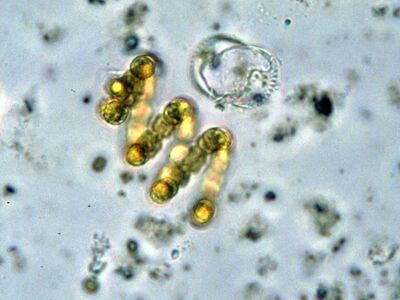 Anabaenaspiroides EPA