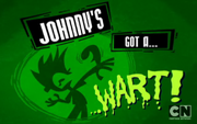 Johnny's Got a Wart!