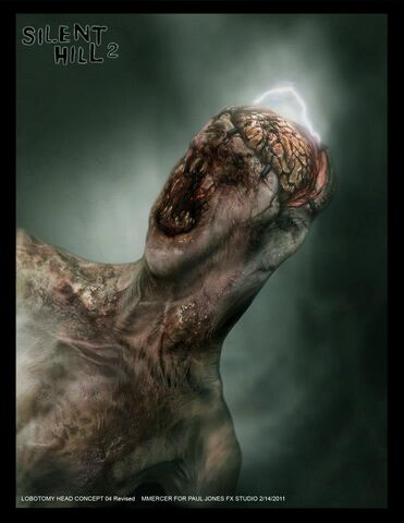 File:Lobotomy ca.jpg