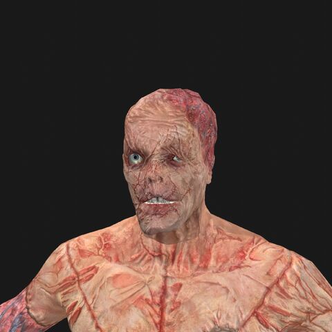 File:Patient7 face.jpg