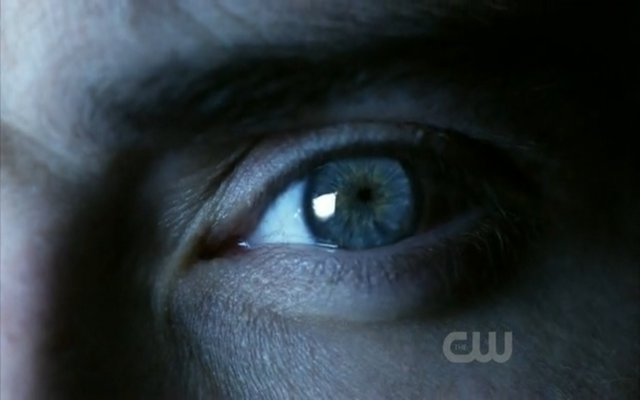 File:Micro vision clarks eye.png