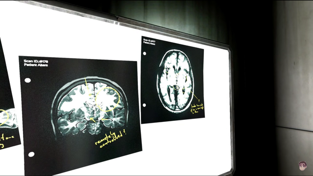 File:Akers Brain scan.png