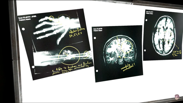 File:Akers X-ray.png