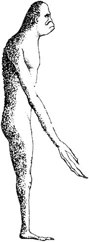 Parasite side