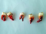 Cropped-bloody-teeth