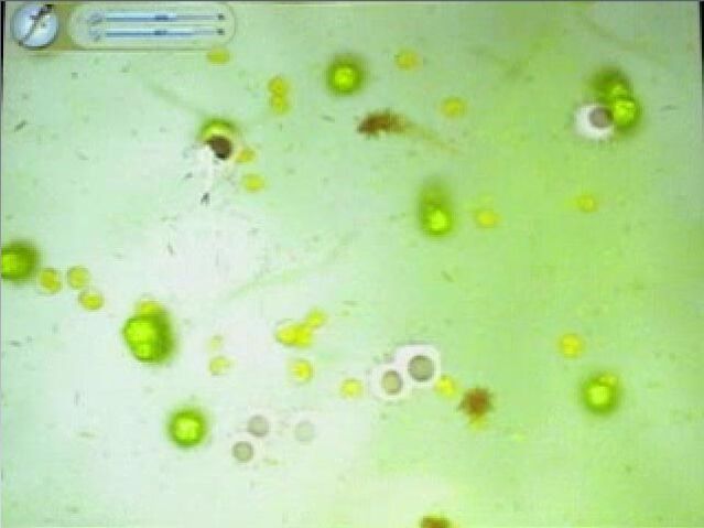 File:Cellattacked.jpg