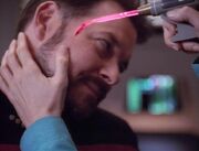Dermal regenerator fom