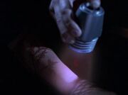 Dermal regenerator muse