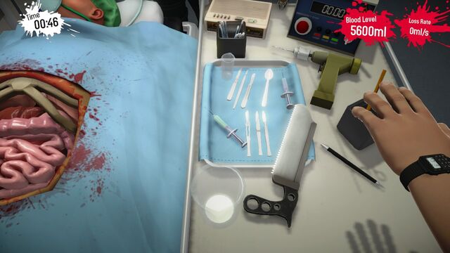 File:Kidney Right.jpg