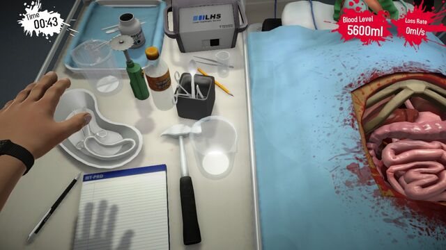 File:Kidney Left.jpg