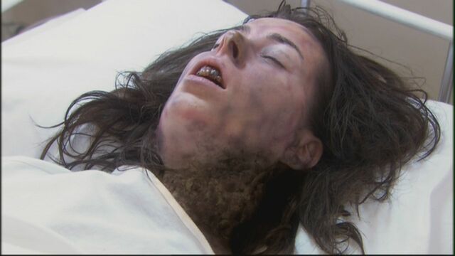File:Plague victim.jpg