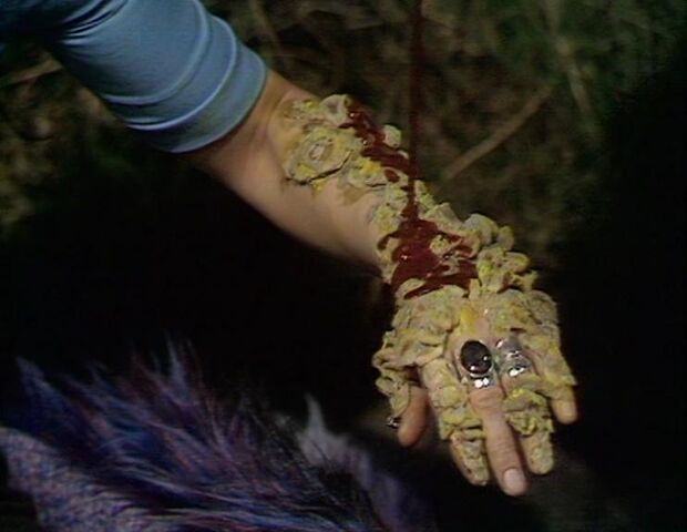 File:Fungoid infection.jpg