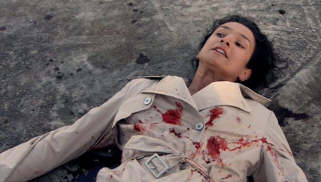 File:Gunshot wounds.jpg