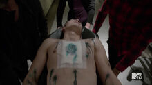 Michael-Johnston-Corey-injured-Teen-Wolf-Season-6-Episode-10-Riders-on-the-Storm