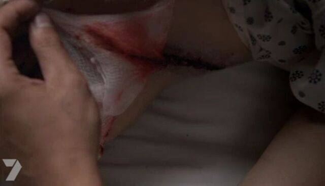 Archivo:Lydia's Wound.jpg