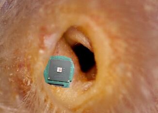 Location of implant in a Kig-yar ear