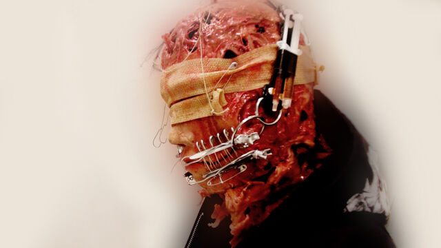 File:Heartworkdiagnosis teaserpic2.jpg