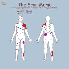Scars