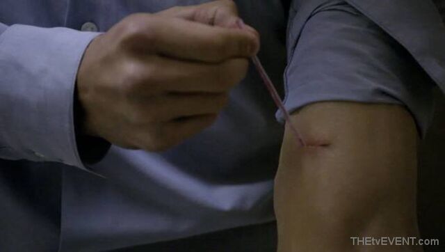 File:1.02-SimonPlasticVein2.jpg