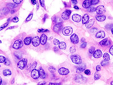 File:Thyroid.jpg