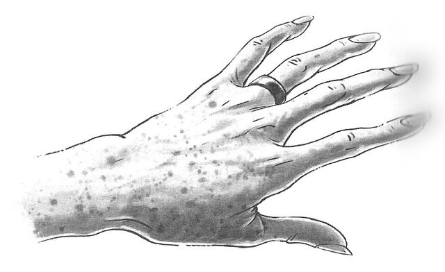 File:Stepmotherring.jpg