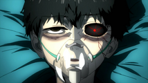 Kaneki tras el transplante.png