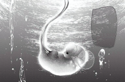 Half-human fetus