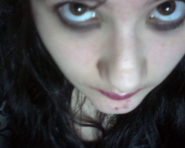 File:Me with chin-zits...blah.jpg