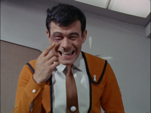File:Mitsuhiro Ide black eye.png
