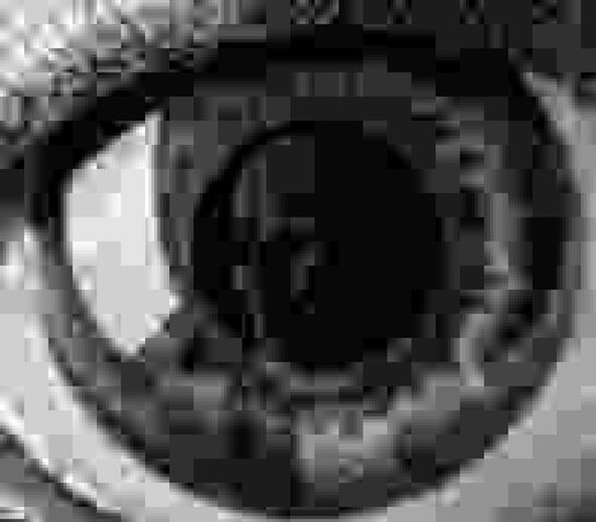 File:Eyezoom500t.jpg