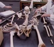 Kolb skeleton