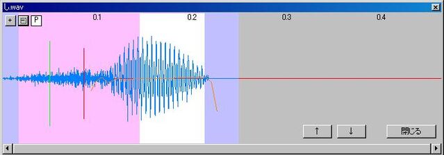 File:10voicesetting4.jpg
