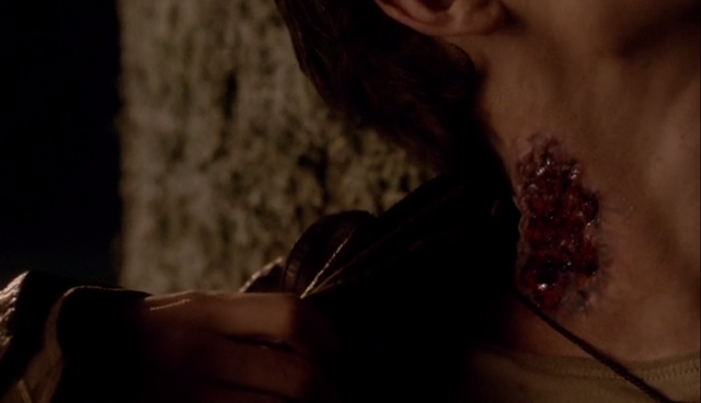 File:Will's bite.png