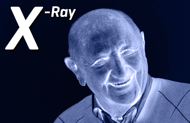File:EncyclopedinsdagXRay.png