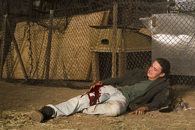File:Baby James injured.jpg