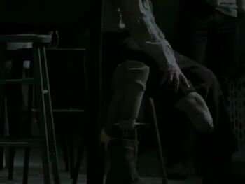 Hershel stump massage