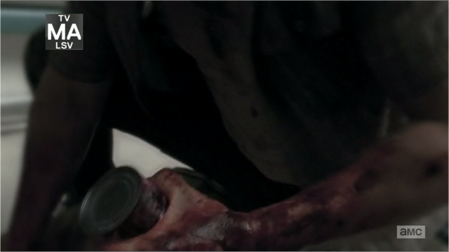 File:5x05 Bloody Hand.png
