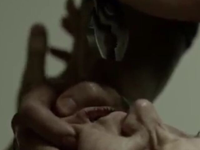 File:Karina's teeth removed.jpg