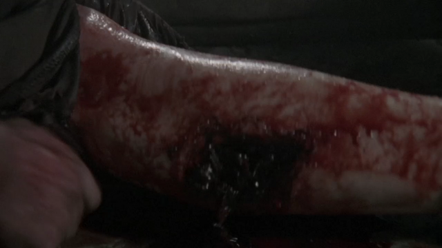File:Hershel's bite leg.png