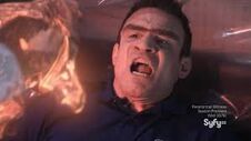 Pete jawbone