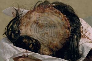 The Maze scalp