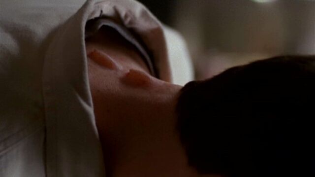 File:Billy Miles' neck.jpg